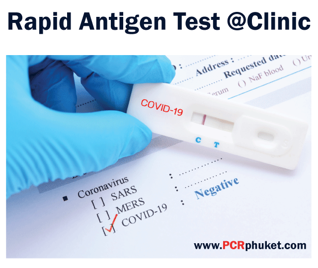 Rapid Antigen Testing (Result 15-20 Min)